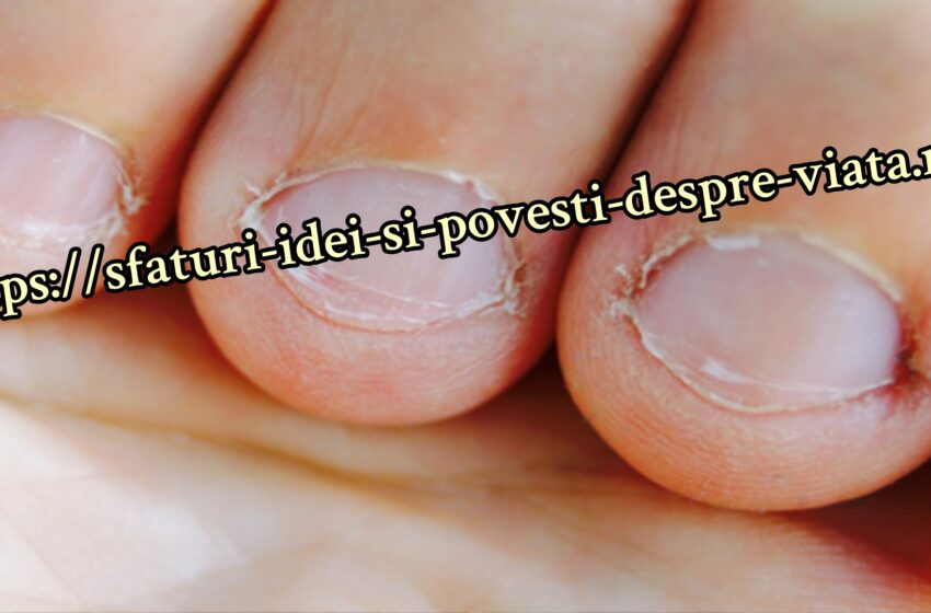 Onicofagia – rosul  compulsiv al unghiilor.Ce pot face părinții.