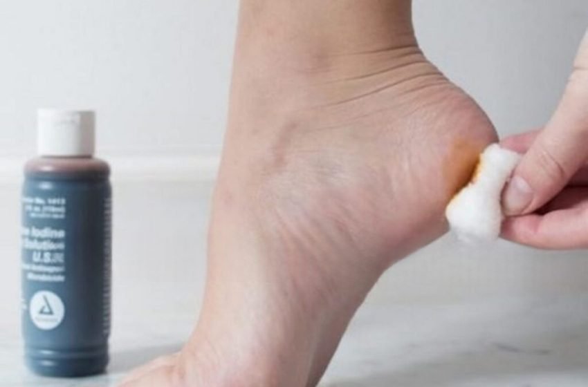  Iodul aplicat seara-vă permite să controlați activitatea multor organe și are un impact direct asupra stării sănătății.