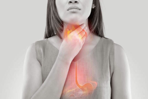  7 alimente care provoacă arsuri la stomac sau reflux acid
