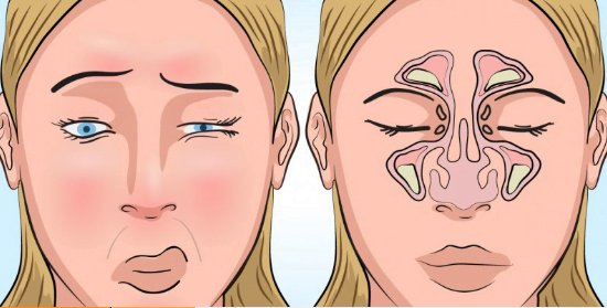  Spune la revedere nasului plin de mucus! 7 remedii eficiente pentru a-l elibera într-un timp scurt