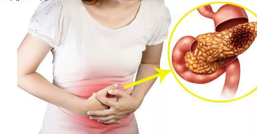  Medicul a spus cum doare pancreasul: 9 semne de pancreatită acută și cronică
