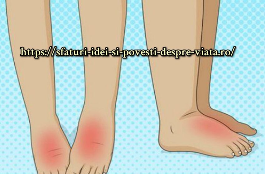  Cum să eliminați Umflarea picioarelor: 12 cele mai simple sfaturi+ cauze