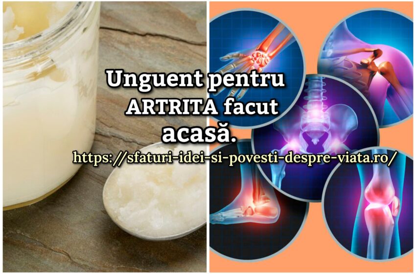  Unguent pentru artrită: cum să-l faci singur acasă.