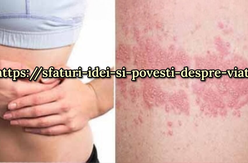  Zona zoster – Simptome,cauze și tratament cu un remediu popular.