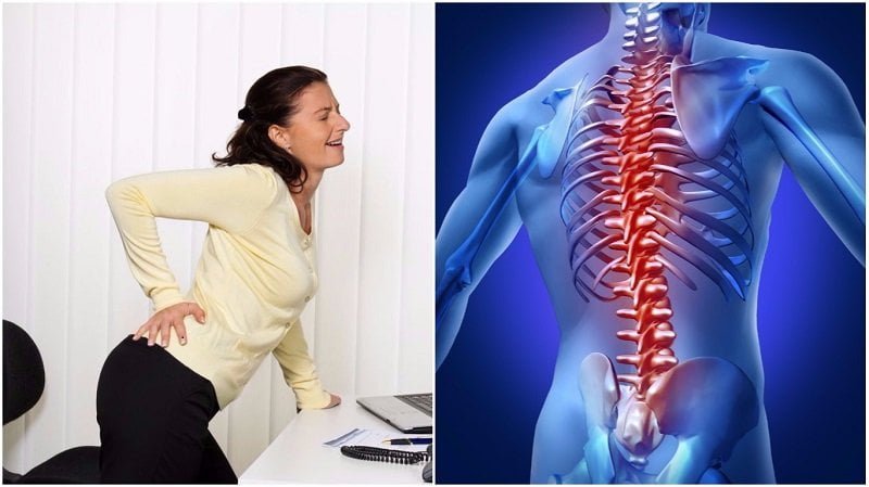  Doar 7 minute pe zi pentru a scapa de durerea spatelui și durerea de la nivelul coloanei vertebrale