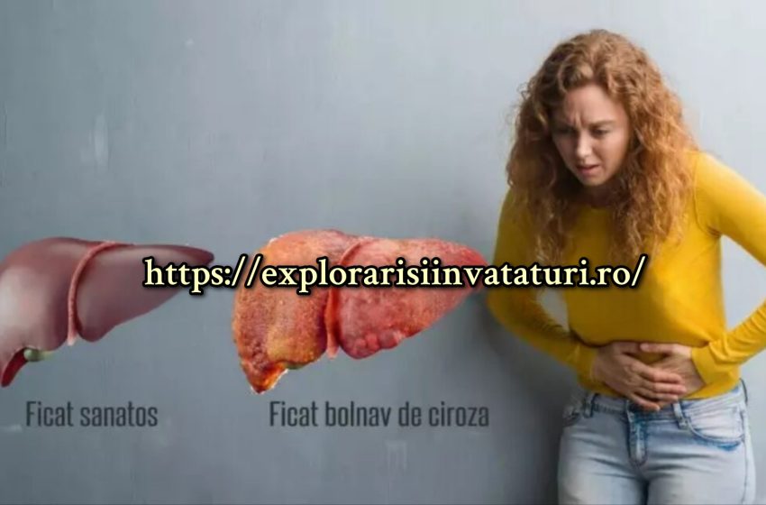  Ciroza hepatică. Tratament cu remedii populare încercate.