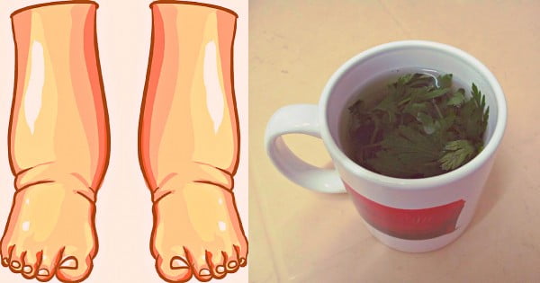  Merită să faceti acest lucru daca aveți picioarele umflate și obosite și cauzele care duc la acestea.