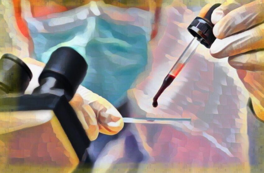  Ascultă semnalele corpului tău: aceste 5 semne indică îngroșarea sângelui