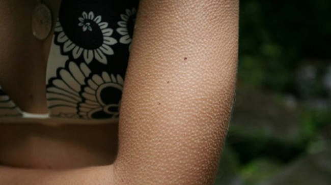 9 lucruri ciudate pe care corpul le face pentru a ne proteja