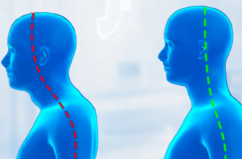  Cum să recunoașteți osteocondroza cervicală: 5 simptome cheie la care să acordați atenție+ doua remedii