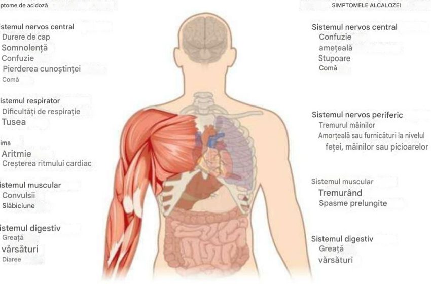  Semne că organismul tău este acid: modalități de a-l alcaliniza.Corpul nu ar trebui să fie niciodată acid.