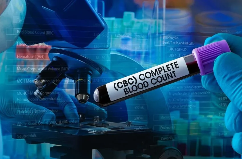  O hemoleucogramă completă (HEC) este un test de sânge care măsoară cantitățile și dimensiunile globulelor roșii, hemoglobinei, leucocitelor și trombocitelor.Cand ai nevoie sa-l faci.Ce verifica testul.