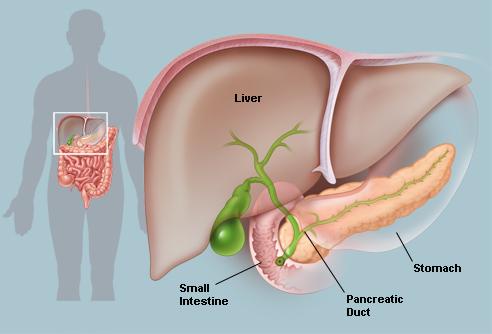  Cancerul pancreatic: „Ucigașul tăcut” – De ce este greu de detectat si alimente care vindecă pancreasul.