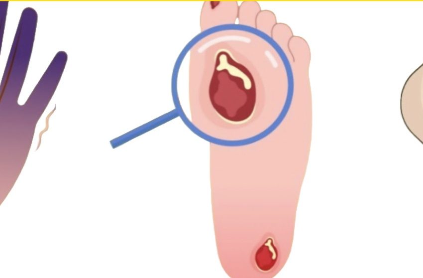  Amorțeala, furnicăturile sau durerea ciudată nu sunt doar disconfort, ci un apel direct din partea organismului care cere ajutor.