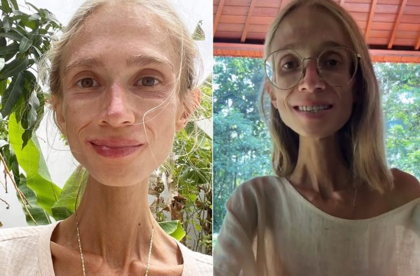  Karolina Krzyzak – o tânără de 27 dupa ce a urmat o cură doar cu fructe.