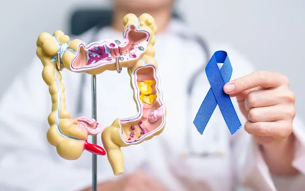  Jemperli (numit și dotarlimab ) un medicament care elimină cancerul de colon si pe cel uterin.