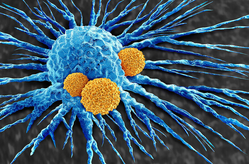  Un mesaj de speranță prin intermediul unui nou tratament pentru cancerele de sânge incurabile.