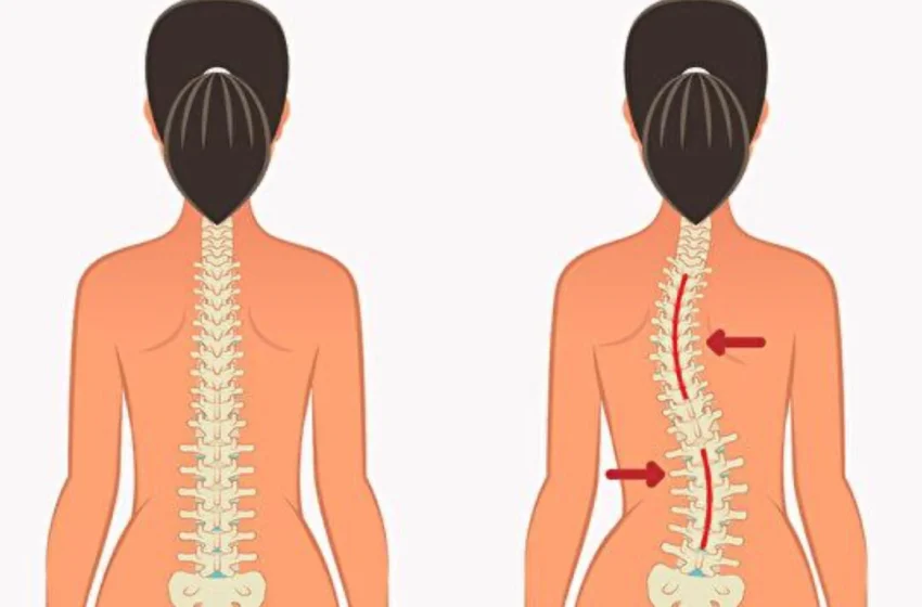  3 mișcări simple din medicina tradițională chineza pentru a îmbunătăți sănătatea coloanei vertebrale și a corecta scolioza