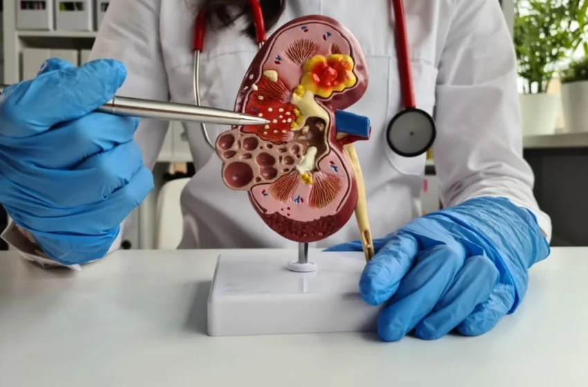  Urolitiază: Medicina tradițională-remedii cu plante.