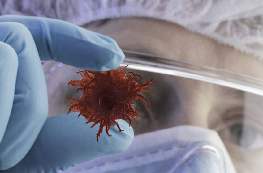  Oamenii de știință din California înfometează cancerul pancreatic: o descoperire în tratament