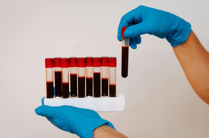  Transfuzia viitorului: oamenii de știință japonezi au creat sânge artificial potrivit pentru toată lumea.