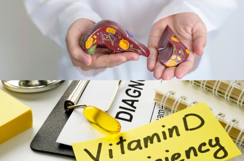  Legătura dintre deficitul de vitamina D și steatoza hepatică
